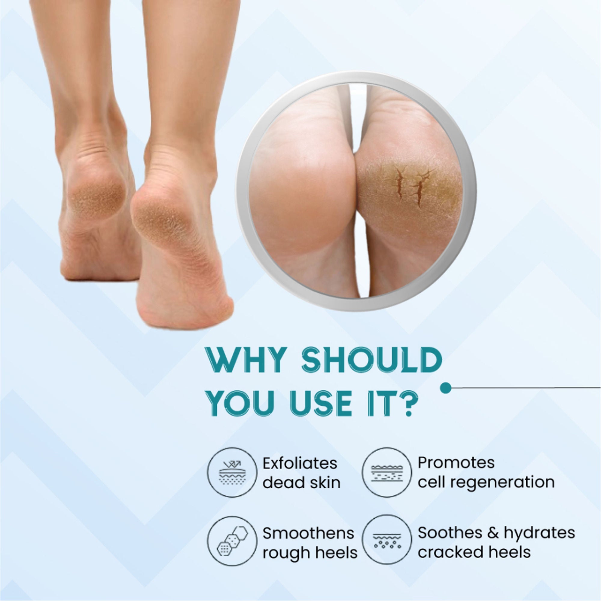 SANCTUS 20% Urea & Hyaluronic Foot Cream Roll On | Grab2Buy