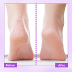 Nykaa Skin Happy Heels 20%Urea, 2%Lactic Acid Foot Cream-Dry & Cracked Feet - Lavender & Peppermint