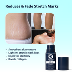 Dermistry Stretch Marks Scar Removal Roll On Oil Serum | Grab2Buy