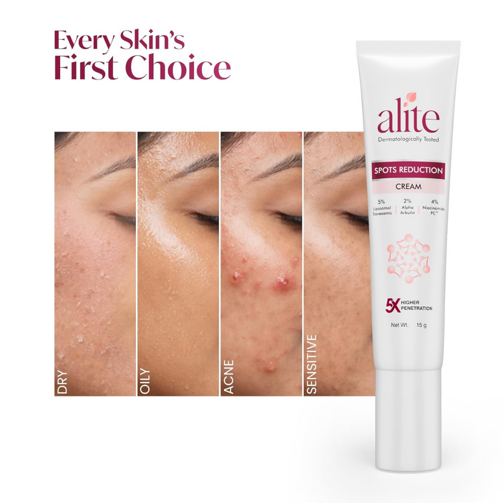 Alite Spots Reduction Cream with 5X Enhanced Absorption | Grab2Buy