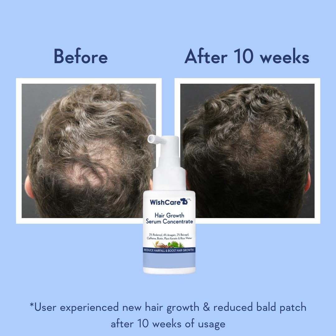 Wishcare Hair Growth Serum Concentrate With 3% Redensyl, 4% Anagain, Rice Water, Biotin | Grab2Buy