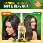 Action Pharma Shampoo Anti-Dandruff Enriched With Neem | Grab2Buy