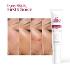 Alite Anti Acne Gel | Grab2Buy