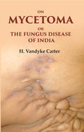 On Mycetoma or the Fungus Disease of India - Gyan Books