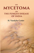 On Mycetoma or the Fungus Disease of India - Gyan Books
