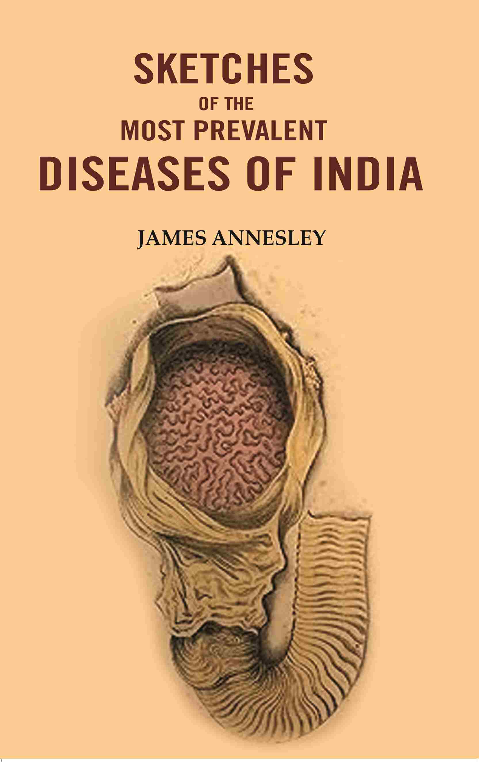 Sketches of the Most Prevalent Diseases of India - Gyan Books