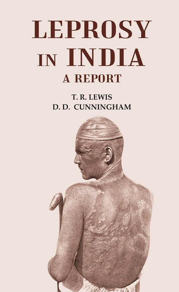 Leprosy in India - Gyan Books | Grab2Buy