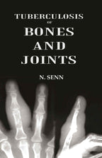 Tuberculosis of Bones and Joints - Gyan Books