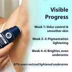 Dermistry AHA Kojic Acid Licorice Niacinamide Underarms Lightening Deodorant Roll On Serum Dark Spots Pigmentation