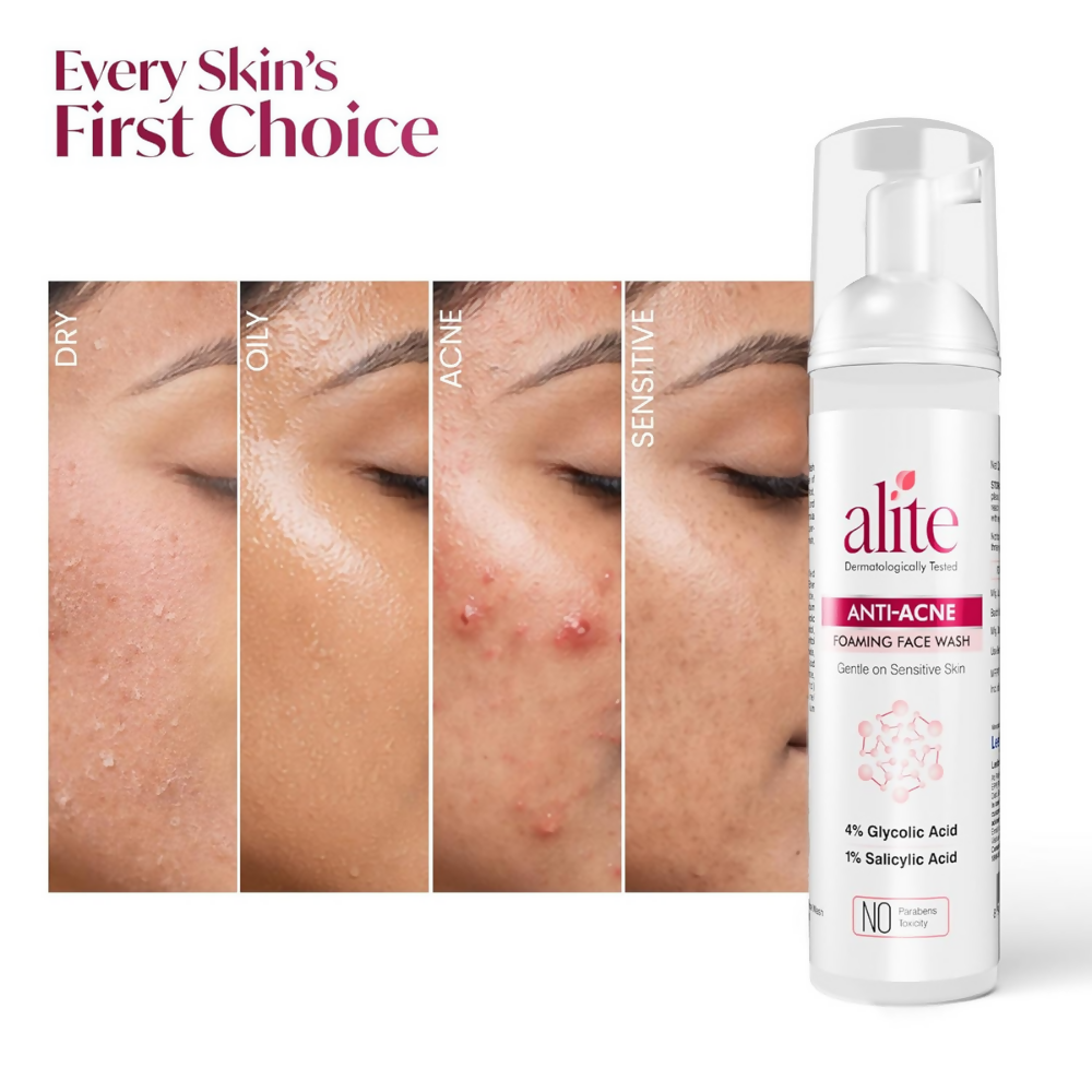 Alite Anti Acne 5-in-1 Foaming Face Wash with 4% Glycolic Acid & 1% Salicylic Acid | Grab2Buy