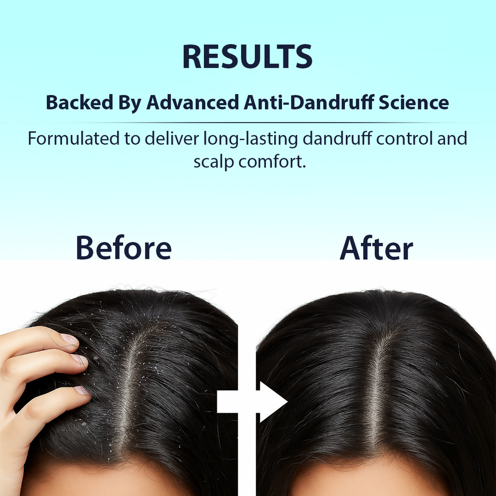 Dermistry Anti-Dandruff Control Hair Serum | Grab2Buy