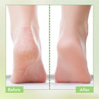 Nykaa Skin Happy Heels 20%Urea, 2%Lactic Acid Foot Cream-Dry & Cracked Feet - Tea Tree & Aloe Vera
