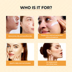 Dr.Sakhiya Acne & Pimple Sunscreen SPF 50