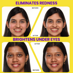 NY Bae HD Spotless Concealer - Golden 04