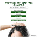 Sesa Ayurvedic Anti-Hair Fall Onion Shampoo | Grab2Buy