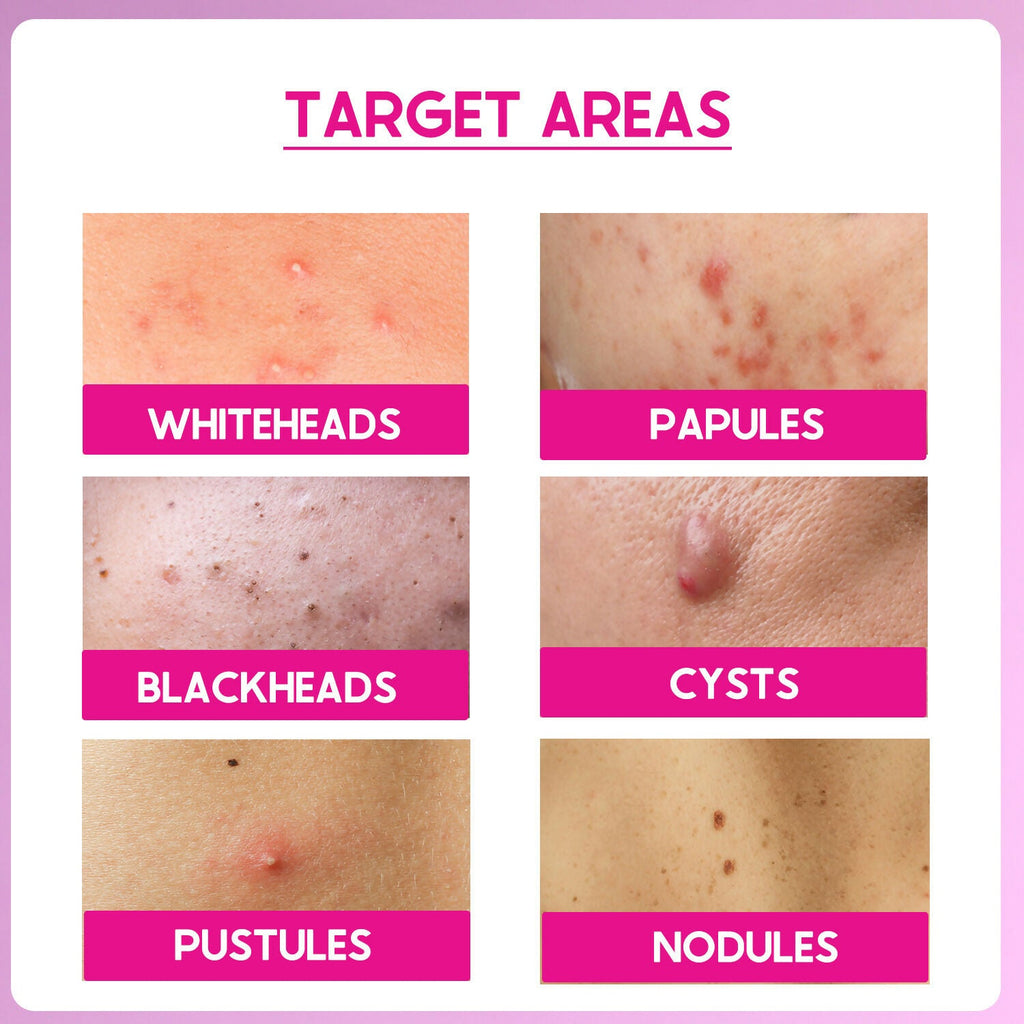 Cos-IQ ABP 11% Beginner Friendly Exfoliating Peel | Grab2Buy
