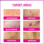 Cos-IQ ABP 11% Beginner Friendly Exfoliating Peel | Grab2Buy