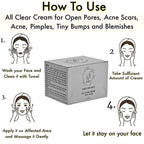 Saroj Organics All Clear Cream For Acne, Pimples | Grab2Buy