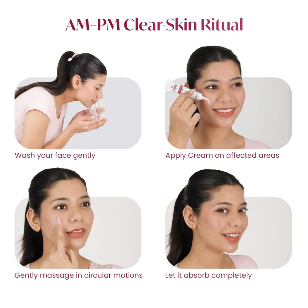 Alite Spots Reduction Cream with 5X Enhanced Absorption | Grab2Buy