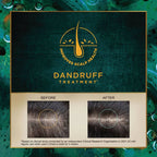 Indulekha Svetakutaja Anti-Dandruff Hair Oil | Grab2Buy