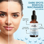 Globus Remedies Niacinamide Anti-Pigmentation Face Serum | Grab2Buy