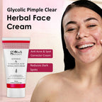 Globus Naturals Glycolic & 1% Salicylic Acid Herbal Anti Acne Face Cream